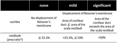 Is Vestibular Meniere's Disease Associated With Endolymphatic Hydrops?